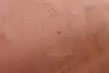 Thumbnail image 14