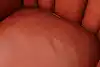 Thumbnail image 17